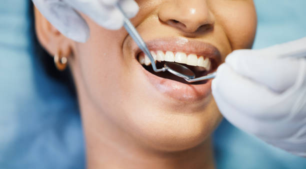 Emergency Dental Filling Replacement in OR